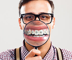 3 Questions You Should Ask Before Undergoing Adult Orthodontics