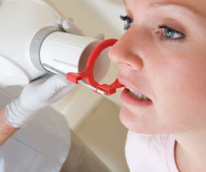 Bitewing X-rays: Your Questions Answered