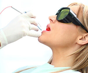 Are Lasers the Future for Treating Advanced Tooth Decay?