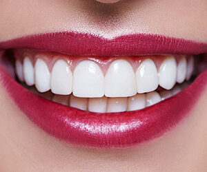 Veneers may Offer a Less Invasive Way to Transform Your Smile