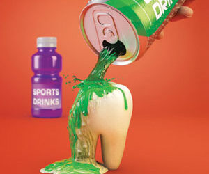 Limit Acidic Beverages to Protect Your Child’s Tooth Enamel from Erosion