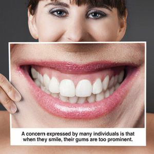 You Don’t Have to Live with a Gummy Smile. Here’s How We Can Change it!