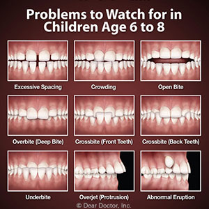 Watch for These Developing Bite Problems with Your Child’s Teeth