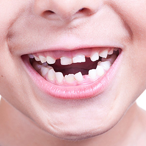 Why it’s Worth the Effort to Save a Problem Baby Tooth