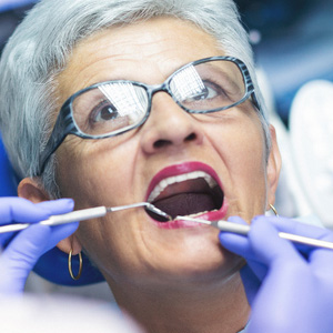 Root Decay in Your Later Years Could Endanger Your Teeth