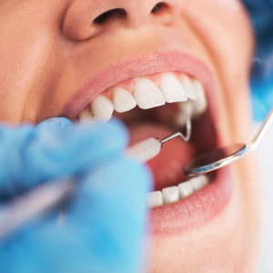 Tooth Decay can be Less of a Problem with Minimally Invasive Dentistry