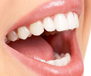 Advances in Porcelain Veneers Improve Both Strength and Appearance