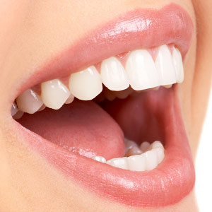 Advances in Porcelain Veneers Improve Both Strength and Appearance