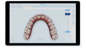 Invisalign Clin Check innovations