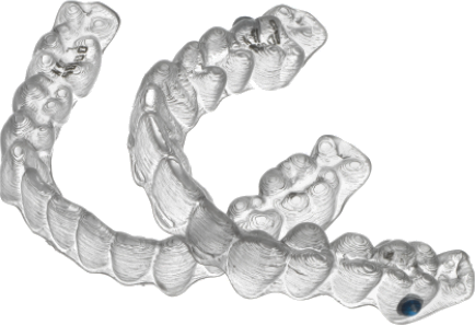 Invisalign Aligner innovations