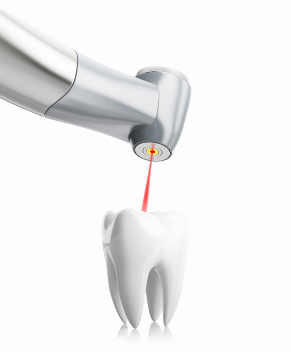 Laser Dentistry