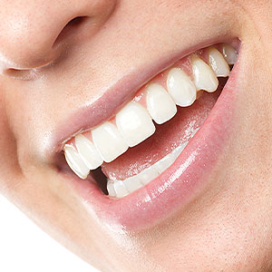 Plan Your ‘Smile Makeover’ to Get the Most Satisfying Results