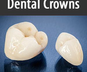 What You Need To Know To Choose the Right Dental Crown