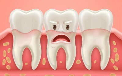 The Main Difference Between Gingivitis vs. Periodontitis