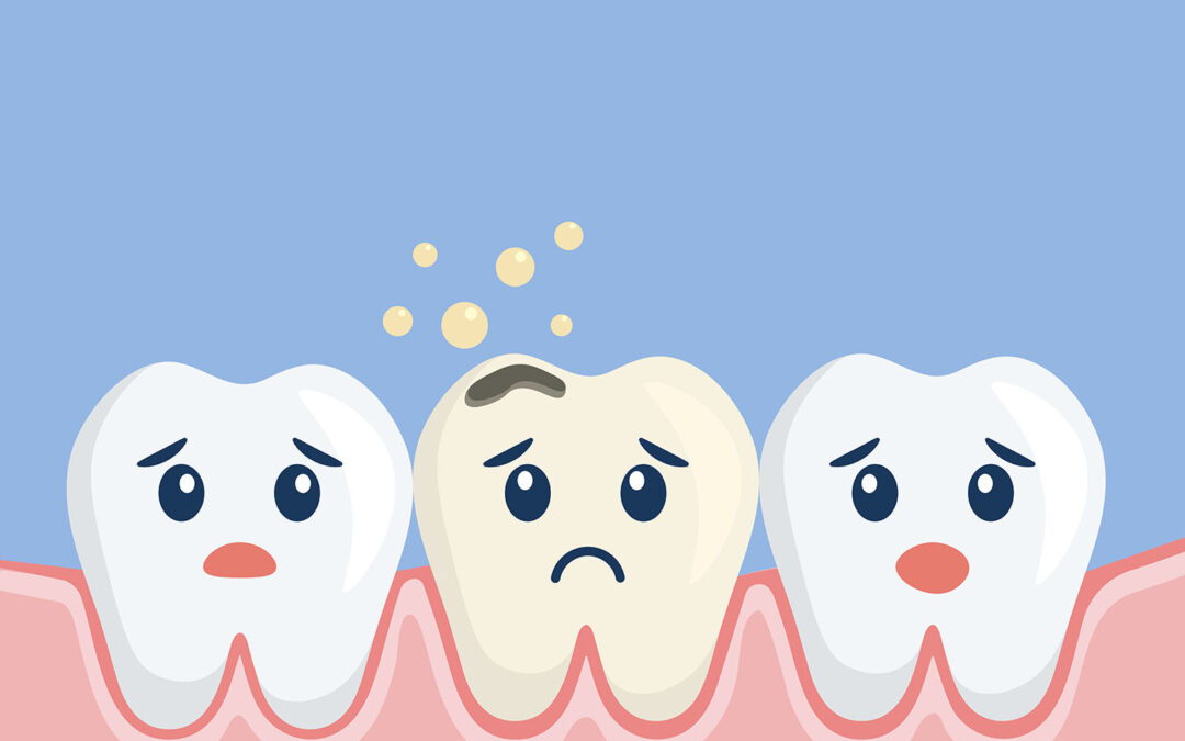 What is an Abscessed Tooth?