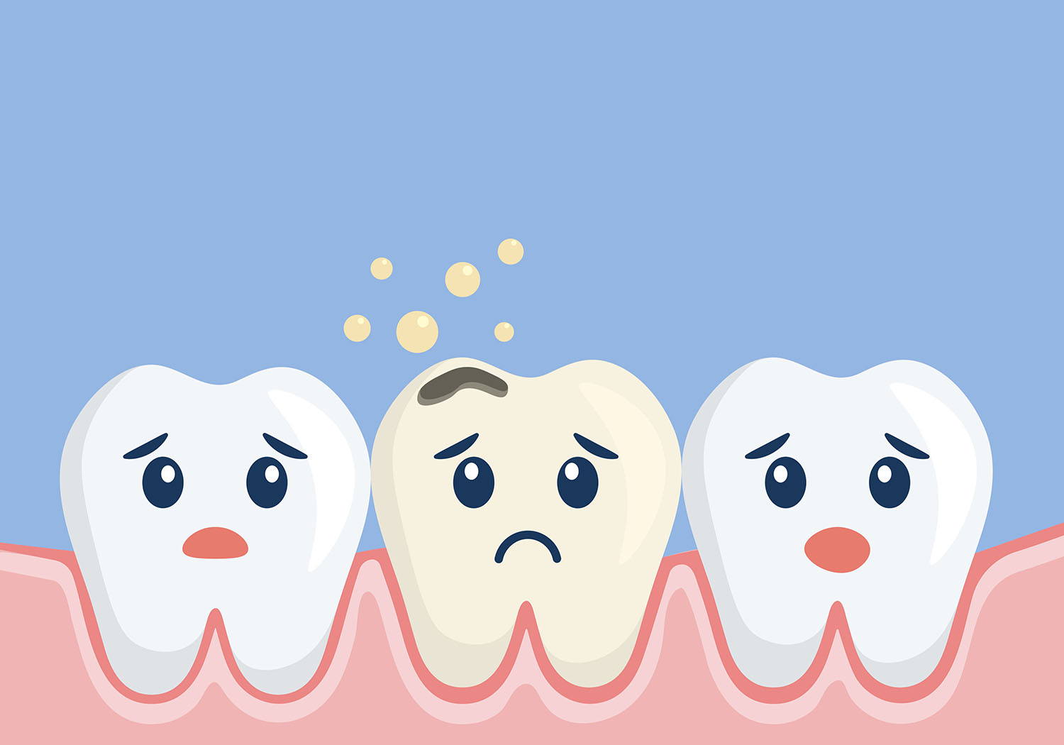 What is an Abscessed Tooth? | Dr. Edward C. Yates
