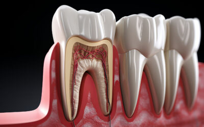 The Timeline of Tooth Enamel Loss and Irreversible Damage